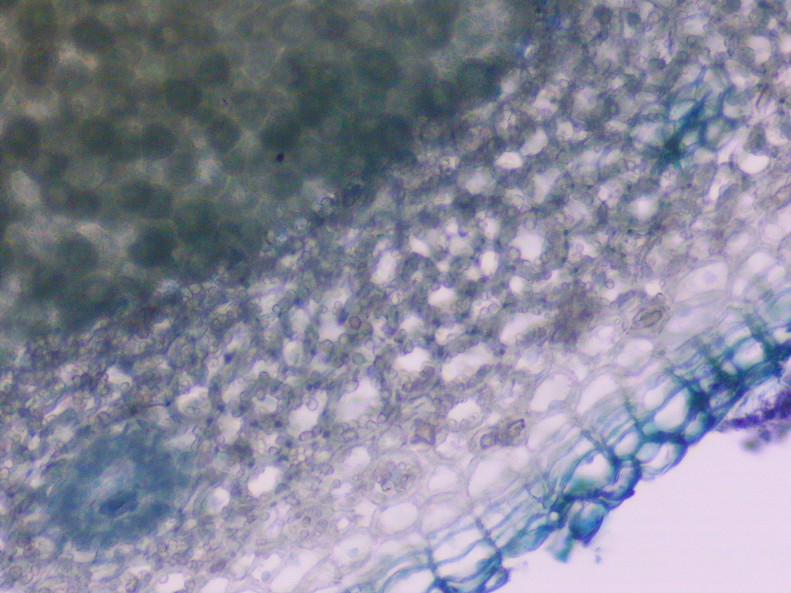 Compound microscope — groundnut root cross-section under high calcium stress