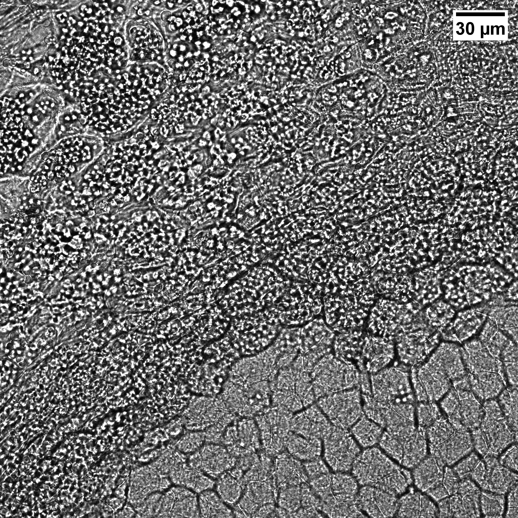 Confocal brightfield — groundnut root cross-section under high calcium stress