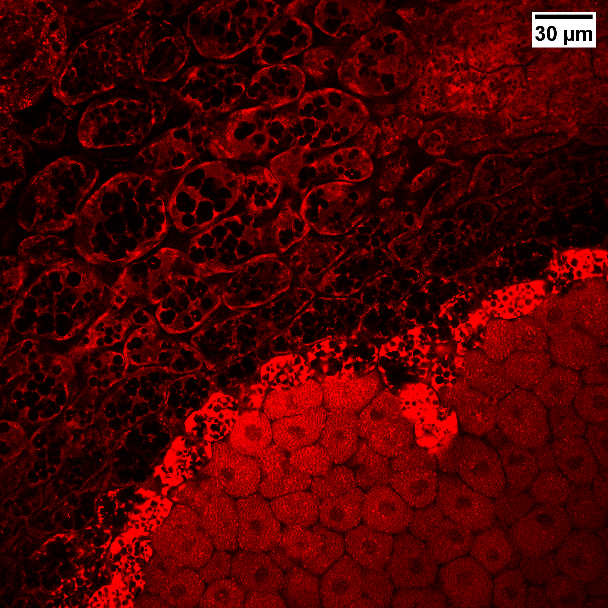 Confocal microscopy (FM 4-64) — fragmented vacuole in groundnut root cross-section under high calcium stress