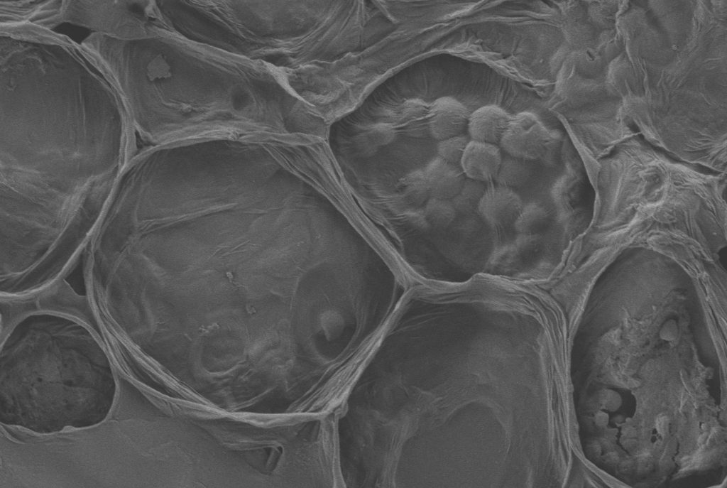Electron microscopy — groundnut root cross-section under high calcium stress